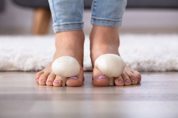 fungus on toenails