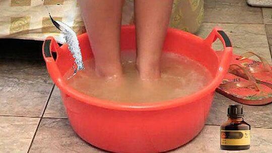 Taking a warm bath with iodine is one of the steps in treating toenail fungus