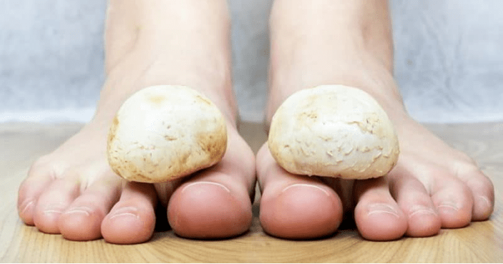 Quick mushroom treatment on the legs of the house