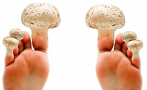 Mushroom on the nails