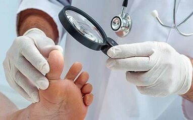 How to get rid of the nail fungus