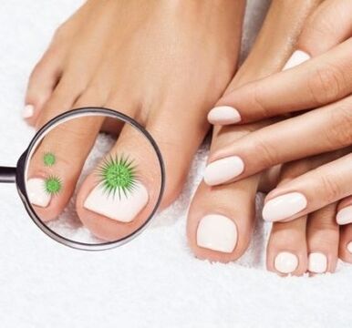 Nail infection through enlargement