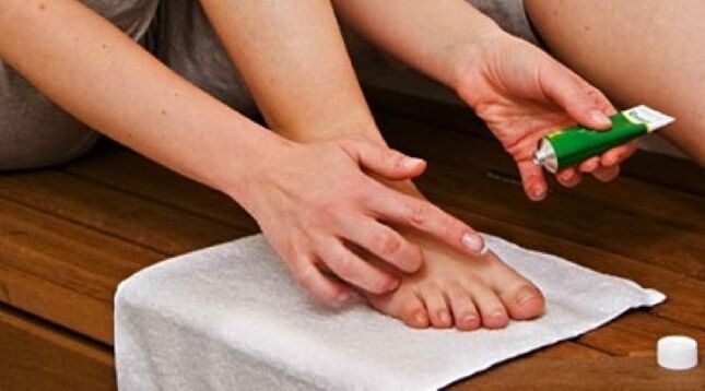 Toenail fungus treatment with ointment